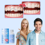 Kit per la Riparazione dei Denti InstaSmile